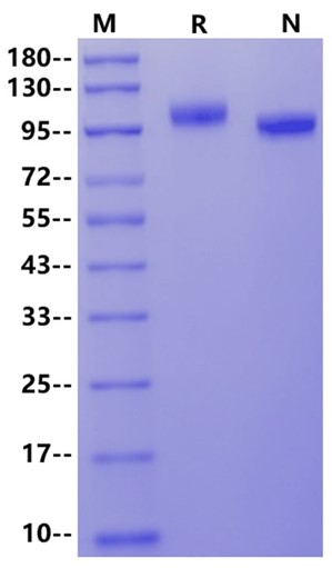 Siglec-2/CD22 His Tag Protein, Mouse