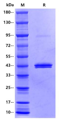Human IDO1 Protein, His tag
