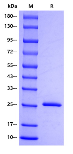 Human UCHL1 Protein, His tag