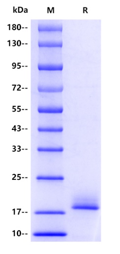 Human MSMP/PSMP Protein, His tag