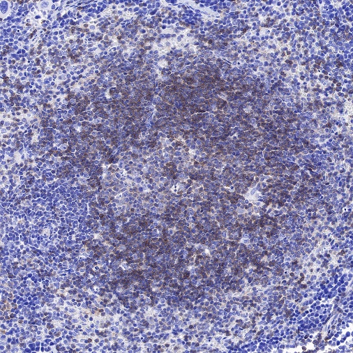 BTLA/CD272 Recombinant Rabbit mAb (S-742-13)