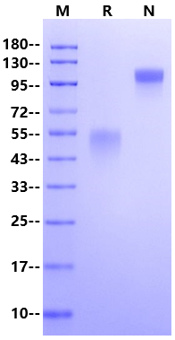 TMEM149/IGFLR1 Fc Chimera Protein, Human