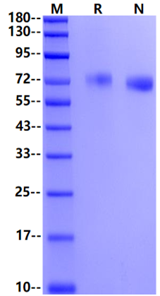 EphA1 His Tag Protein, Human