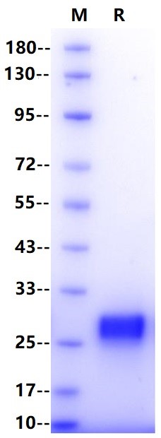 UMP-CMP kinase/CMPK1 His Tag Protein, Human