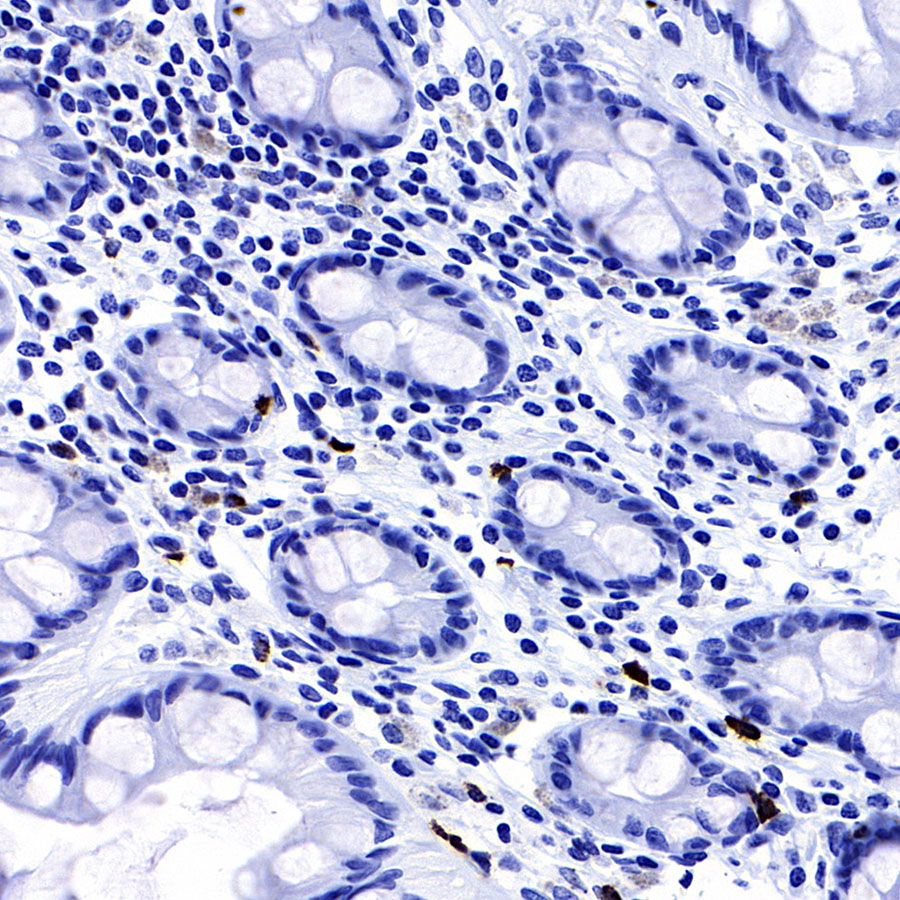 TPSAB1 Recombinant Rabbit mAb (SDT-R038)