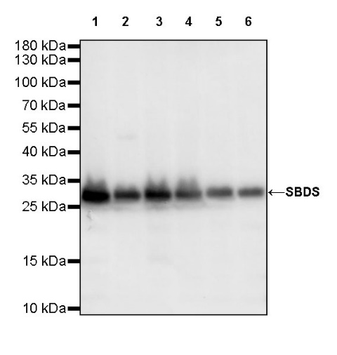 SBDS Recombinant Rabbit mAb (S-R344)