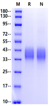 EPCR/PROCR His Tag Protein, Mouse