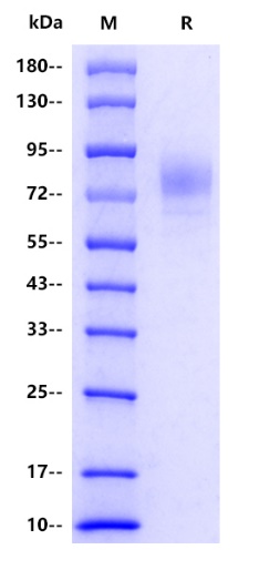 Human IgM Protein, His tag