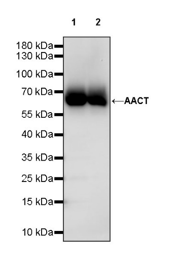 AACT Recombinant Rabbit mAb (S-897-32)