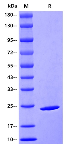 Human COL6A1/Collagen VI Protein, His tag