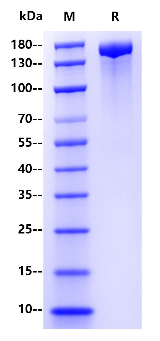 SARS-CoV-2 (BA.4&BA.5/Omicron) S, His Tag Protein