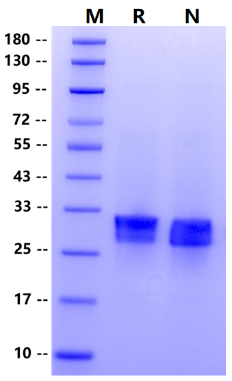 DENR His Tag Protein, Human