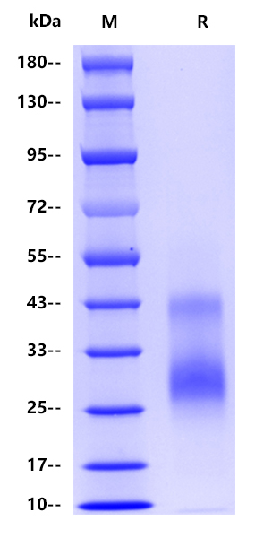 Human HVEM/CD270/TNFRSF14, His tag