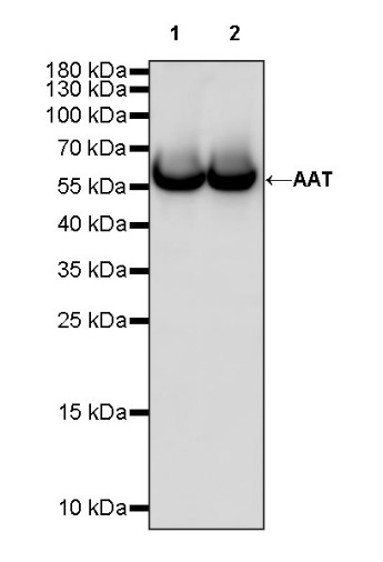 AAT Recombinant Rabbit mAb (S-943-37)