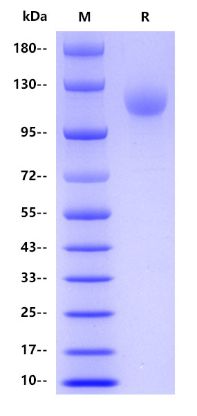Human CD42b, His tag