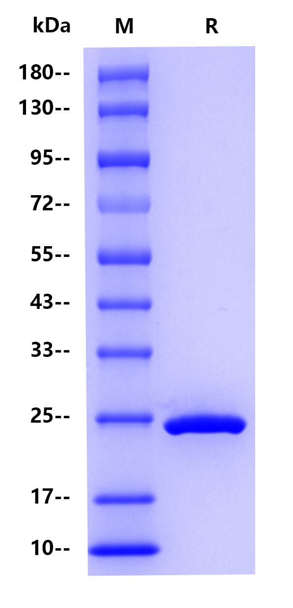Schistosoma japonicum GST, His tag