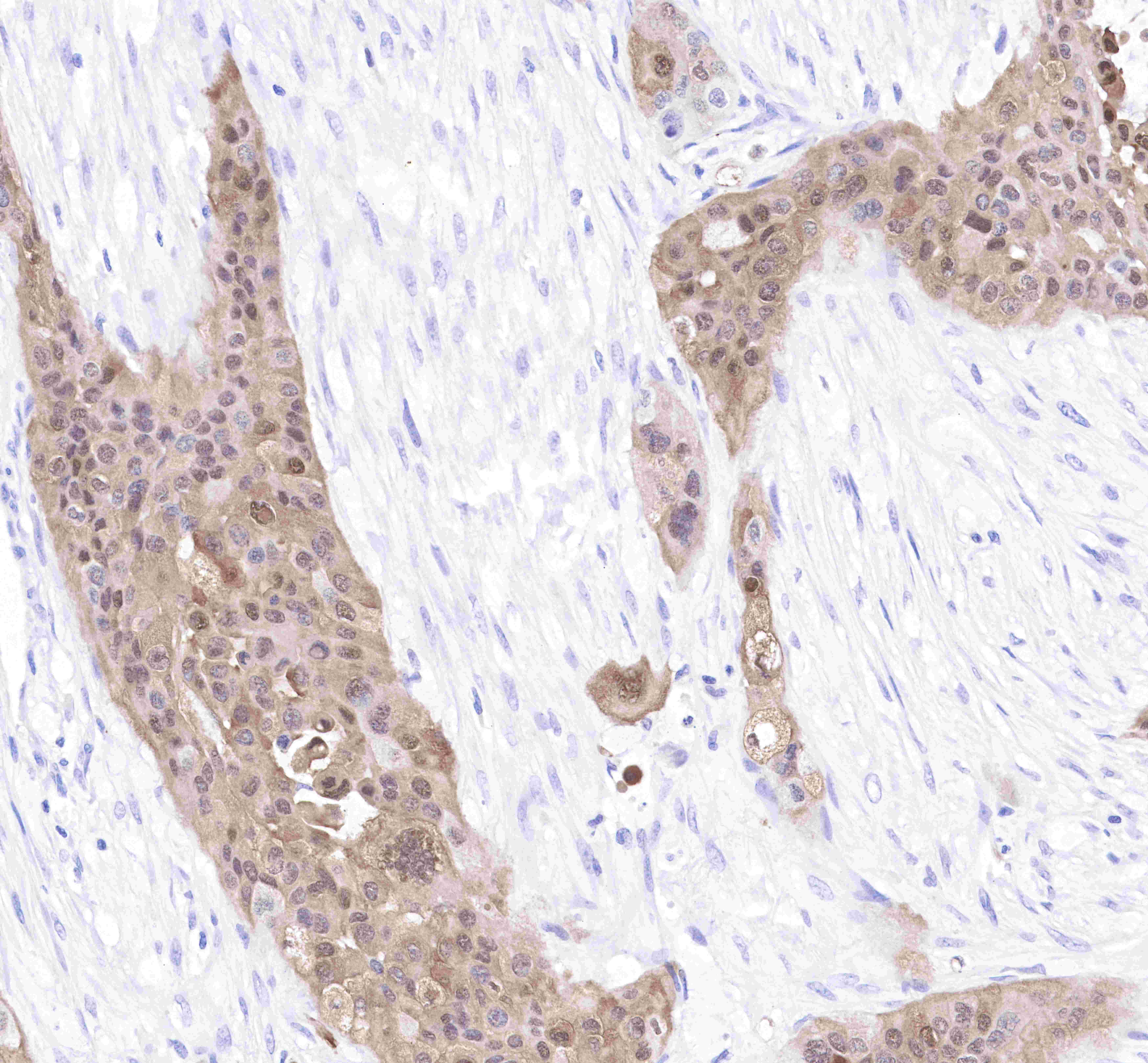 S-RMab® S100P Recombinant Rabbit mAb (SDT-070-44)