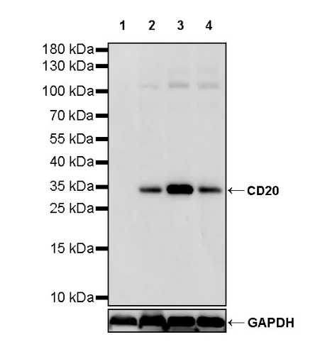 CD20 Recombinant Rabbit mAb (SDT-038-205)