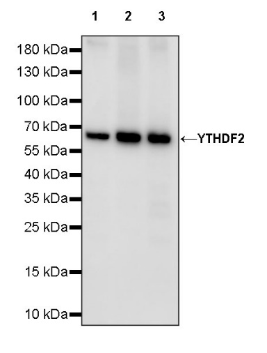 YTHDF2 Recombinant Rabbit mAb (S-1569-42)