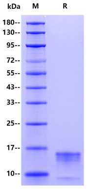 Monkeypox virus A29L, His Tag