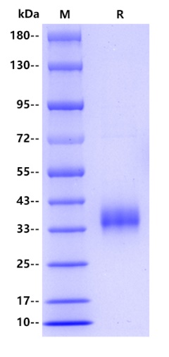 Human Langerin/CD207 Protein, His tag