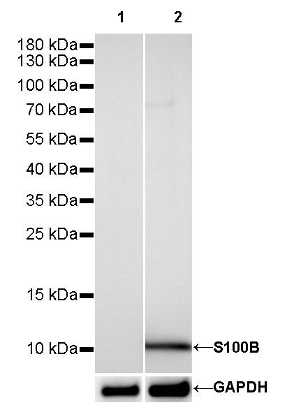 S100B Recombinant Rabbit mAb (SDT-093-108)