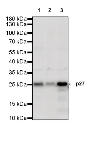 p27 Recombinant Rabbit mAb (SDT-R350)