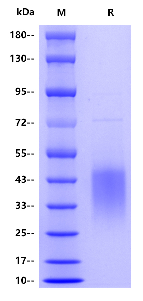 Human CD28, His tag