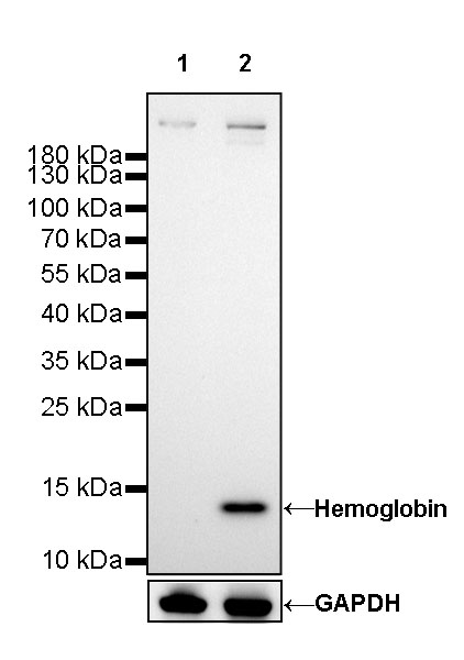 Hemoglobin Recombinant Rabbit mAb (SDT-193-71)
