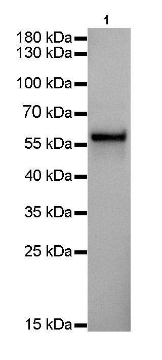 Keratin 5 Recombinant Rabbit mAb(SDT-014-67)