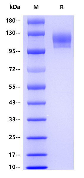 Human CD29 , His tag