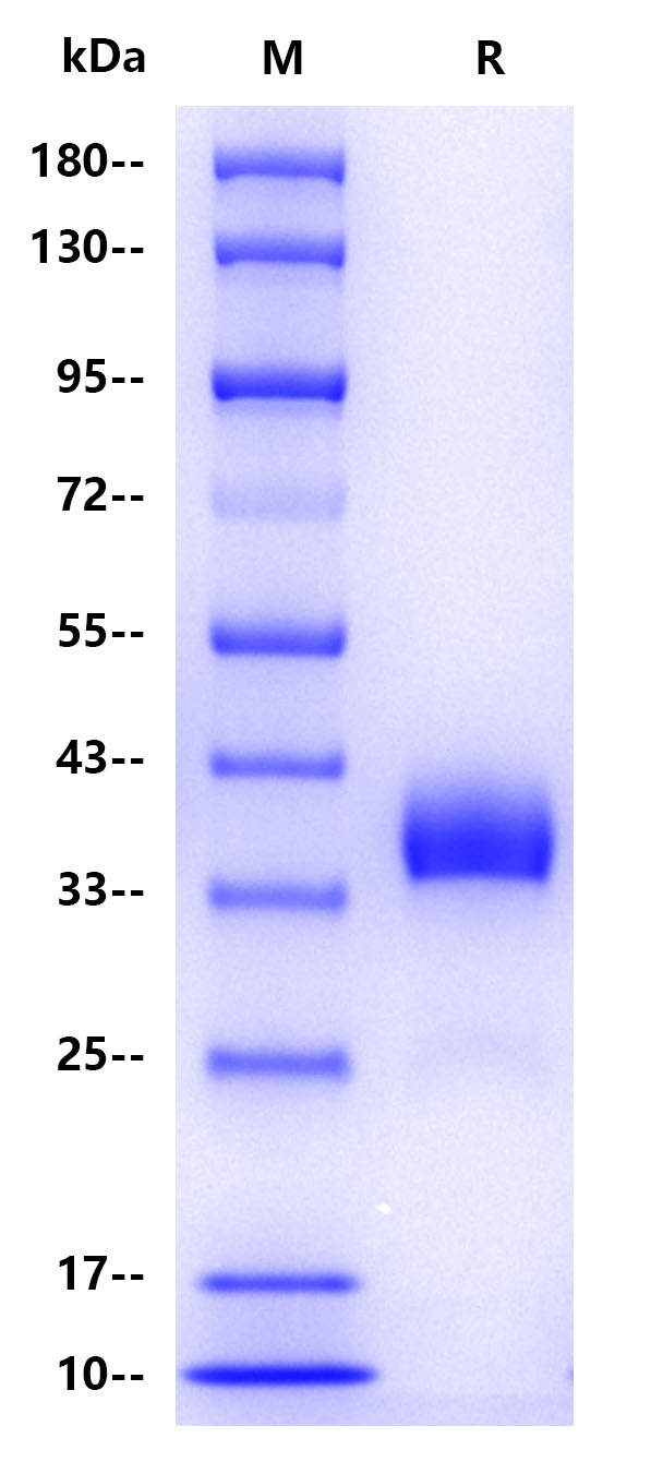Human Thrombomodulin, His tag