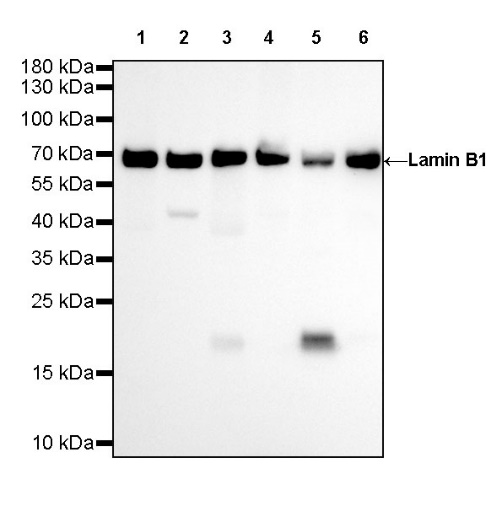 Lamin B1 Recombinant Rabbit mAb (SDT-307-108)