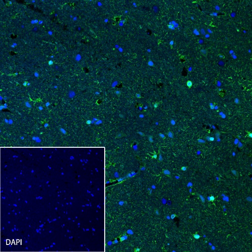 S100B Recombinant Rabbit mAb (Alexa Fluor® 488 Conjugate) (SDT-518-45)