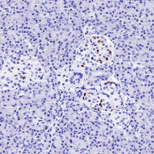 Somatostatin Recombinant Rabbit mAb (S-1103-79)
