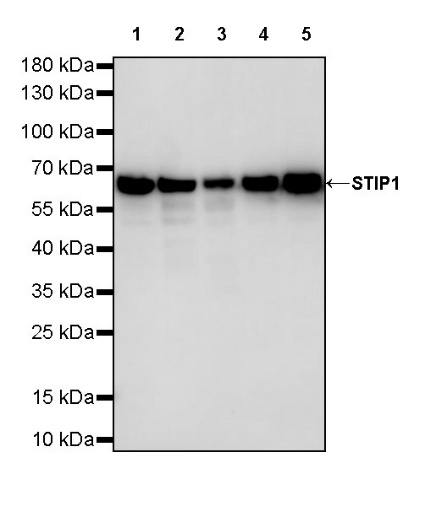 STIP1 Recombinant Rabbit mAb (S-680-39)