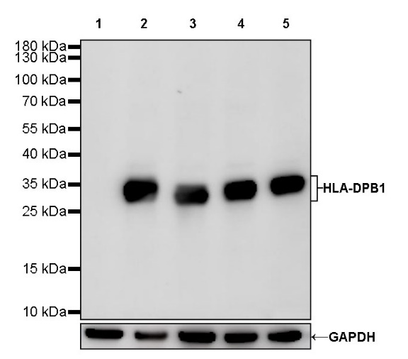 HLA-DPB1 Recombinant Rabbit mAb (S-R263)