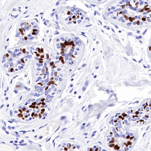 S-RMab® Estrogen Receptor α Recombinant Rabbit mAb (SDT-R371)