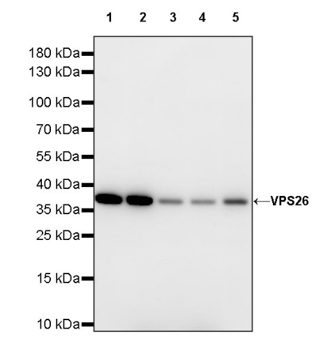 VPS26 Rabbit Polyclonal Antibody