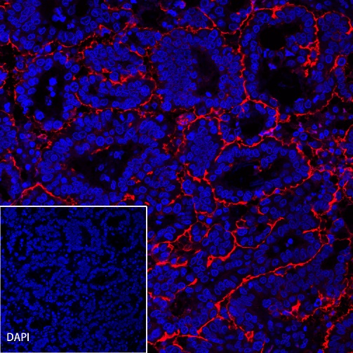 CA125 Recombinant Rabbit mAb (Alexa Fluor® 555 Conjugate) (SDT-555-41)