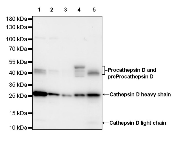 Cathepsin D Recombinant Rabbit mAb (S-R345)