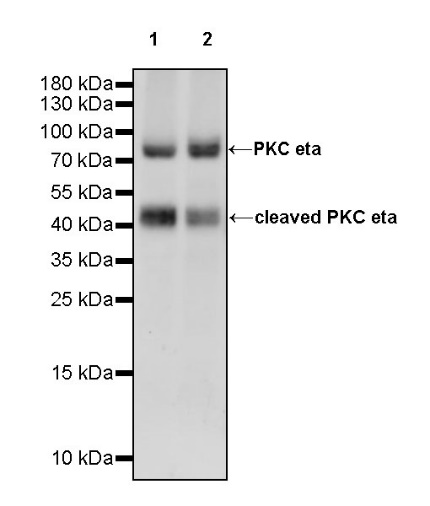 PKC eta Recombinant Rabbit mAb (S-1053-35)