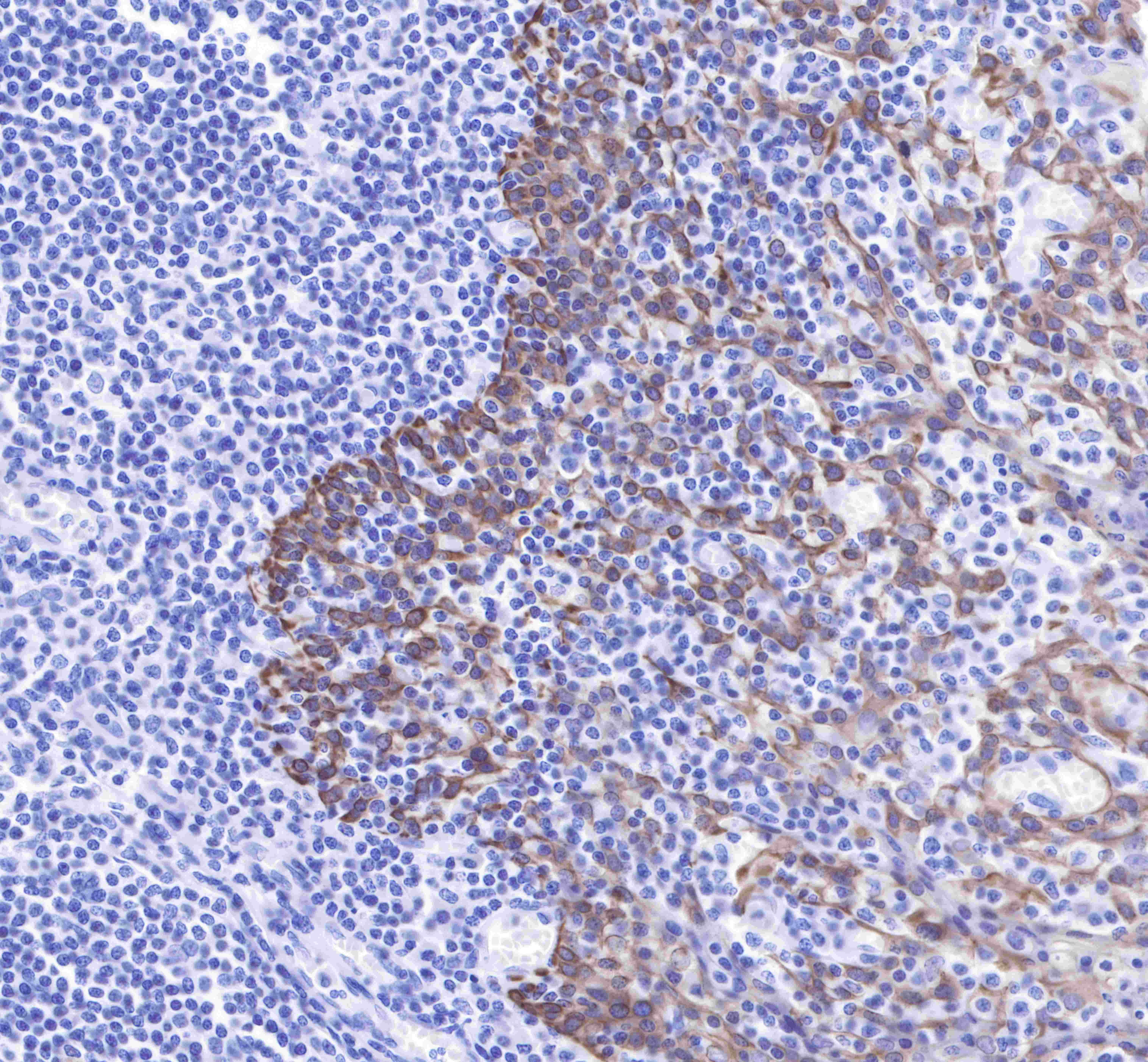 OneStep polymer HRP Goat anti-Rabbit and Mouse IgG (H+L) (specific for IHC)