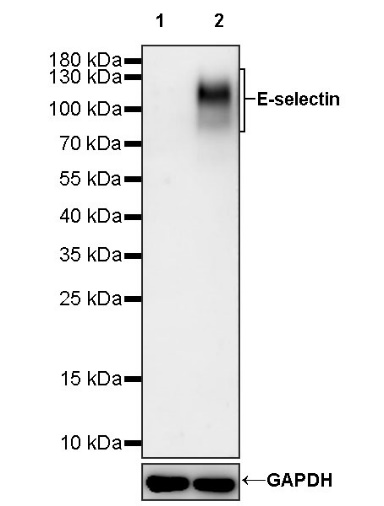 E-selectin Recombinant Rabbit mAb (S-1260-26)