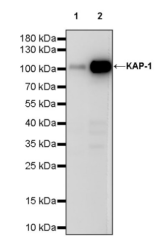 KAP-1 Recombinant Rabbit mAb (S-986-5)