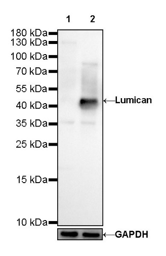 Lumican Recombinant Rabbit mAb (S-247-47)