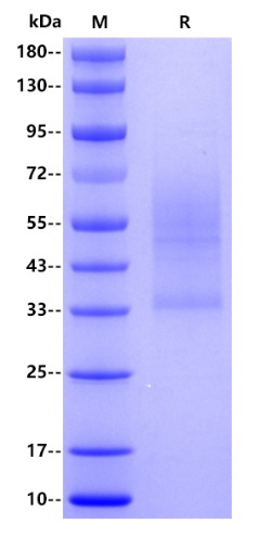 Human CD44, His tag