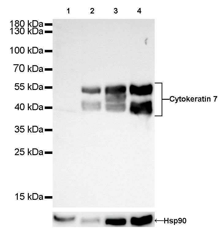 S-RMab® Cytokeratin 7 Recombinant Rabbit  mAb (SDT-121-17)