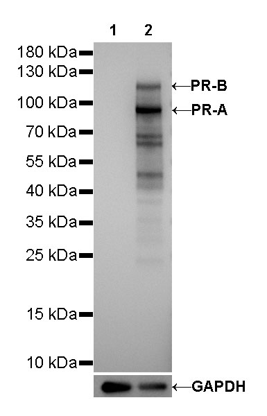 Progesterone Receptor Recombinant Rabbit mAb (SDT-R123)