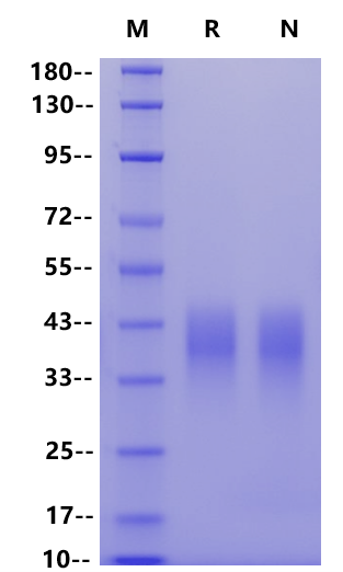 SLAMF7/CRACC/CD319 His Tag Protein, Mouse
